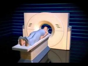 chup ct scans co tang nguy co ung thu khong