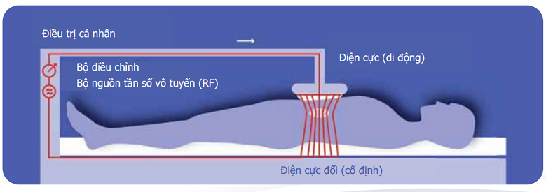 tang than nhiet ho tro dieu tri ung thu