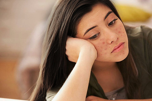 thieu-tu-tin-vi-mun-2606