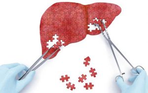 Các phương pháp phục hồi chức năng gan sau điều trị gan nhiễm mỡ